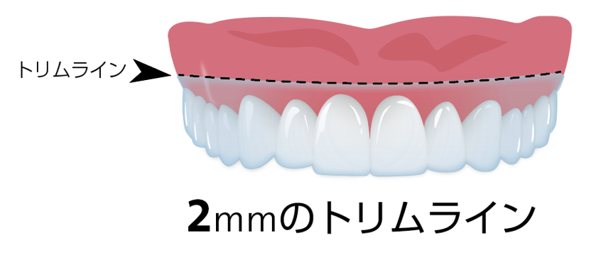 クリアコレクト トリムライン|Refino Dental Clinic