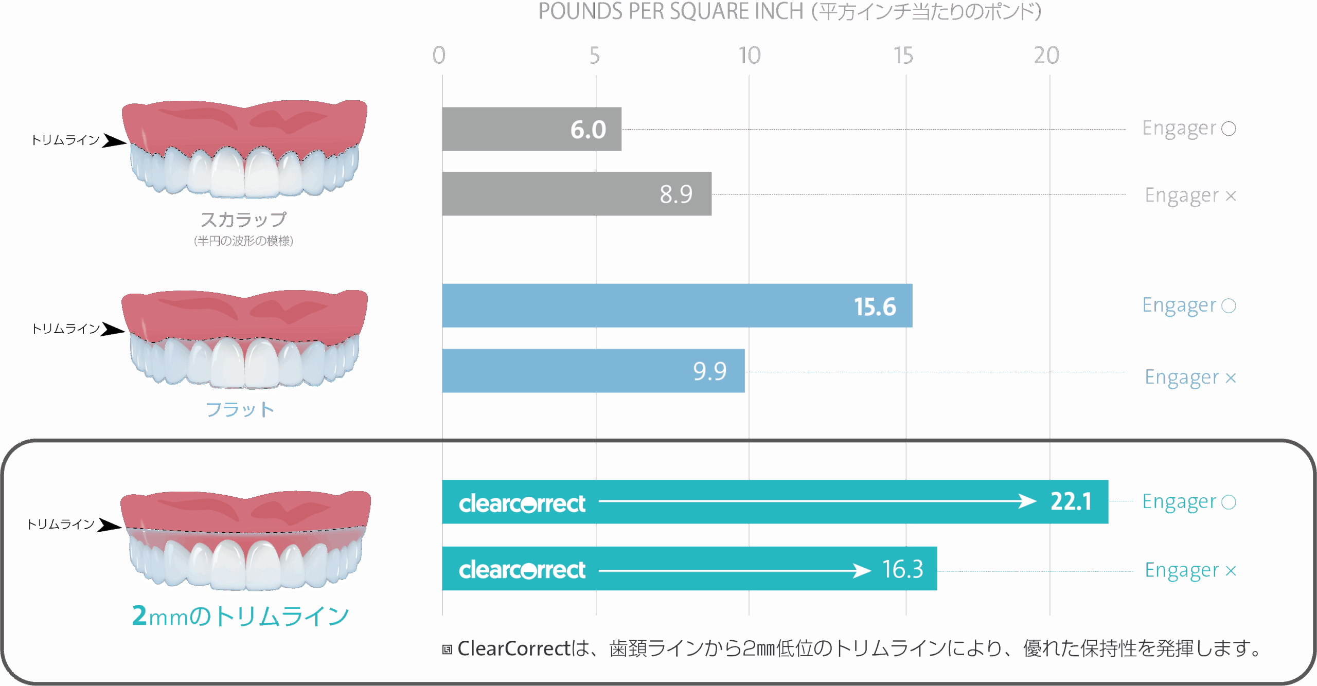 トリムラインの違い|Refino Dental Clinic