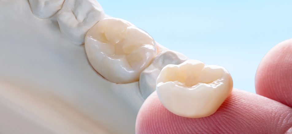 オールセラミックやジルコニア|refino dental