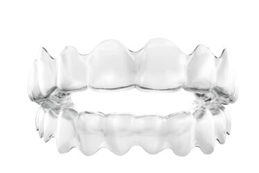 マウスピース矯正