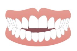 オープンバイト