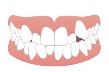 simple illustration 131_1