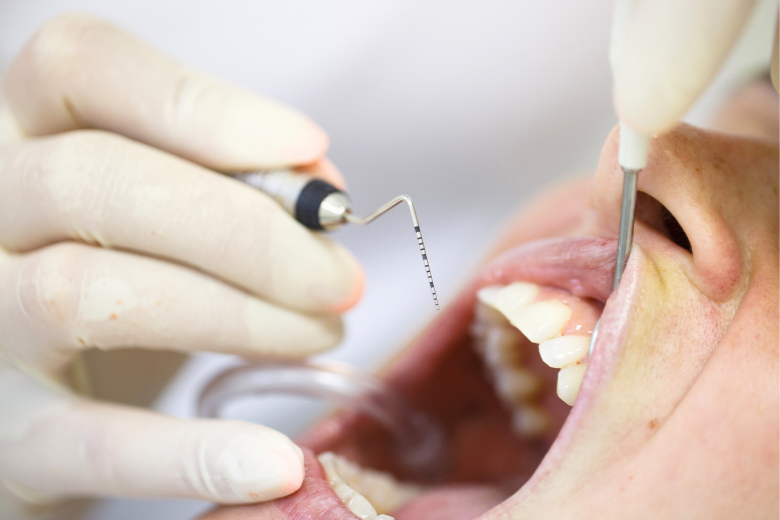 歯周病|refino dental