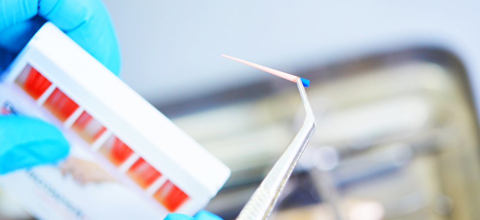 根管充填材料|refino dental