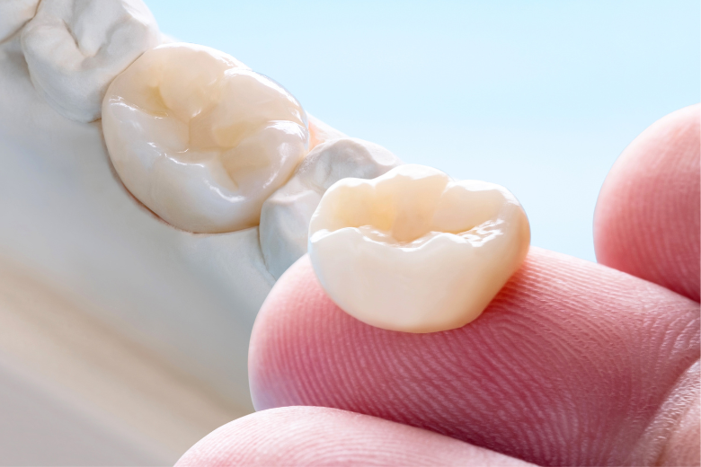 セラミック治療|refino dental