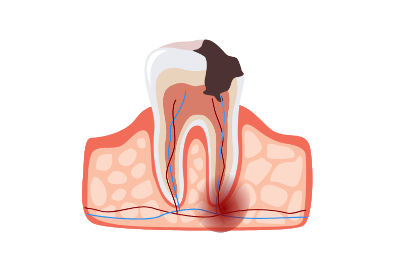 歯がボロボロになってお困りの方へ|refino dental