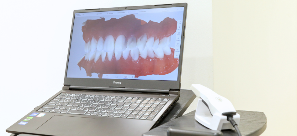 口腔内スキャナー|refino dental