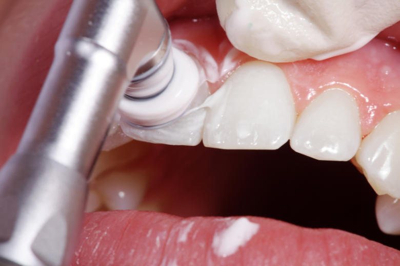 PMTC|refino dental