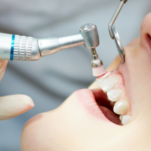 ポリッシングペースト|refino dental