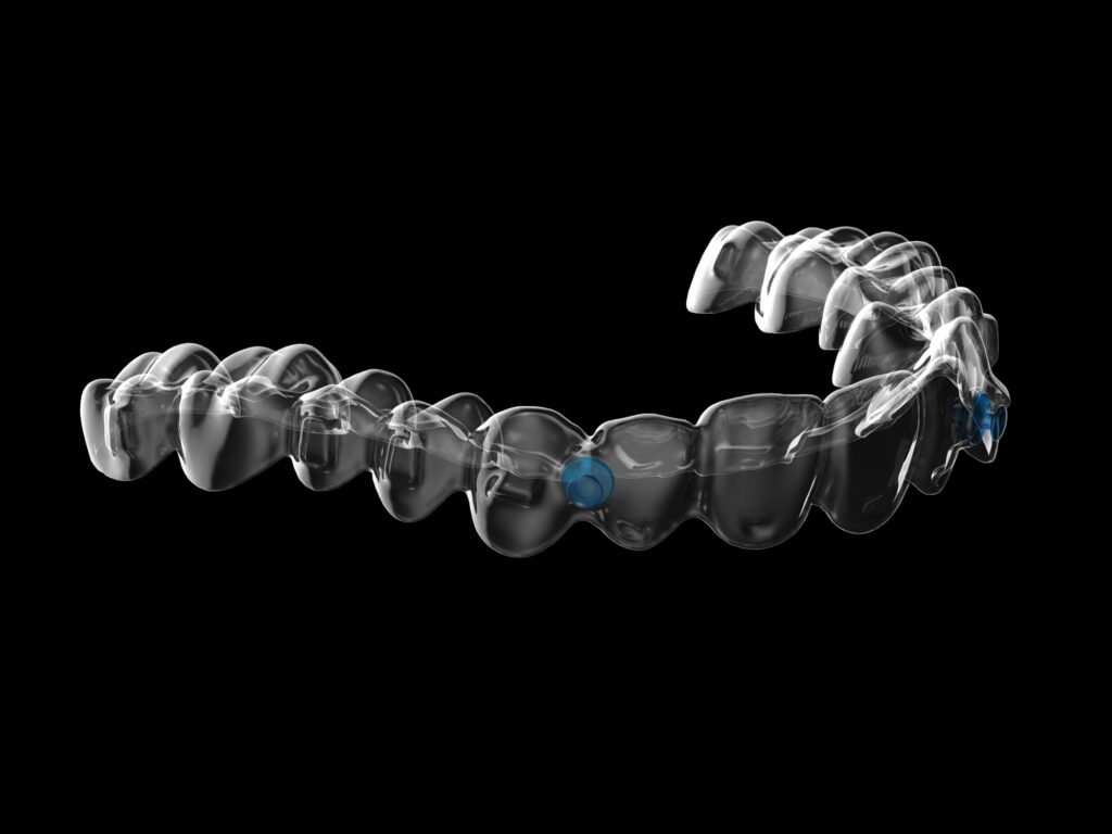 エンジェルボタン