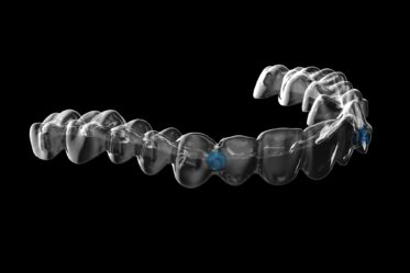 エンジェルボタン