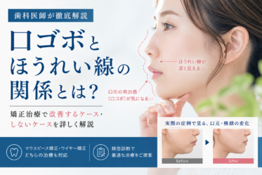 口ゴボ　ほうれい線