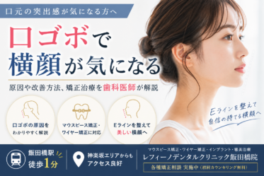 口ゴボ 横顔
